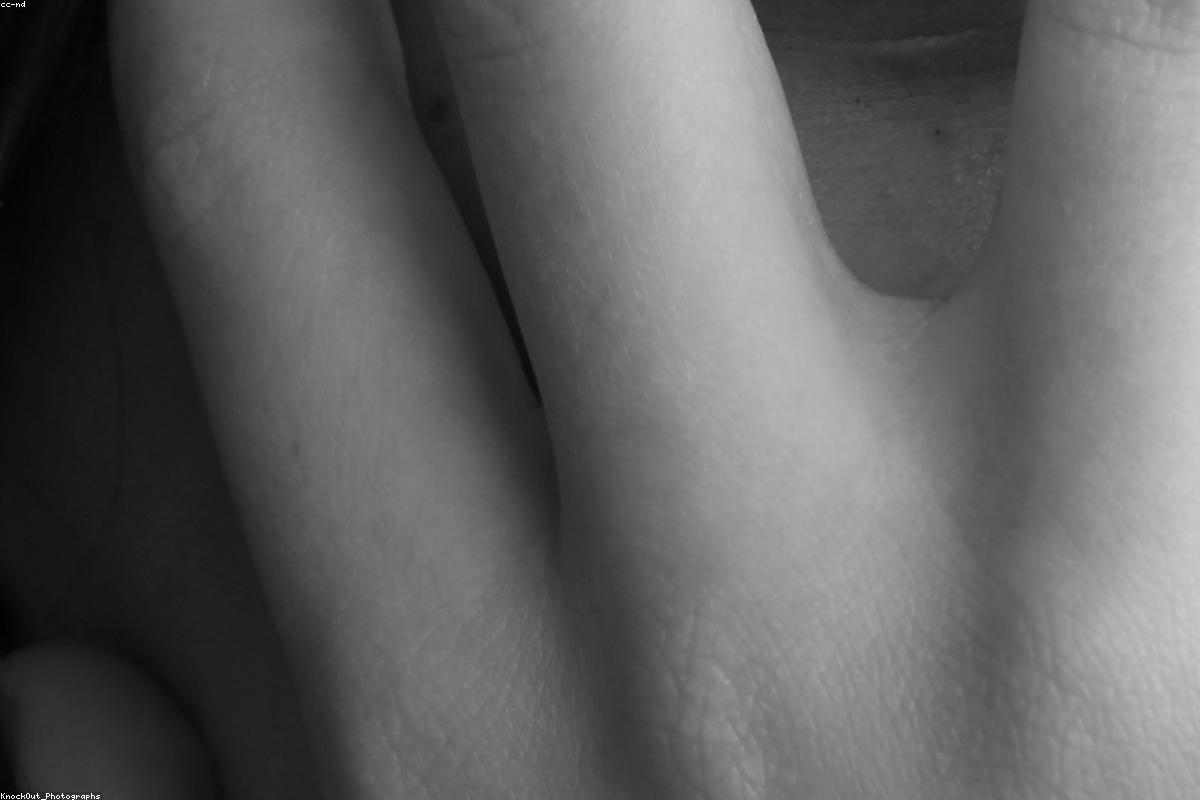 Safety shield representing backup protection